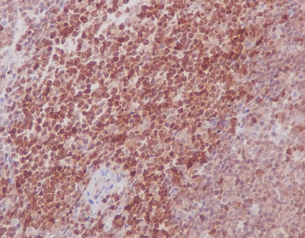 MEK3/MEK6 Rabbit mAb ABZ5061