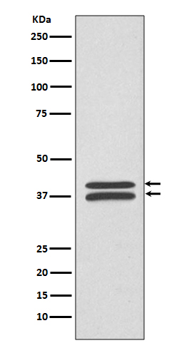 MEK3/MEK6 Rabbit mAb ABZ5061