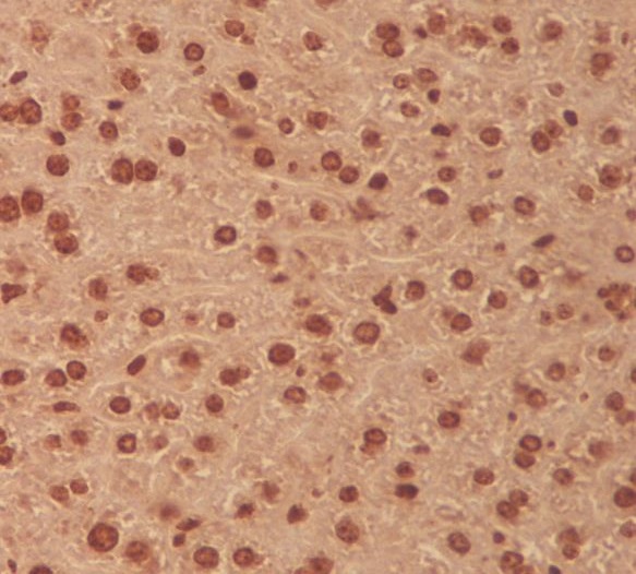 MEK3 Rabbit mAb ABZ5062