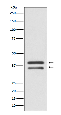 MEK3 Rabbit mAb ABZ5062