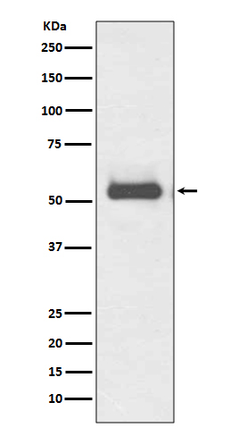 TFG Rabbit mAb ABZ5064