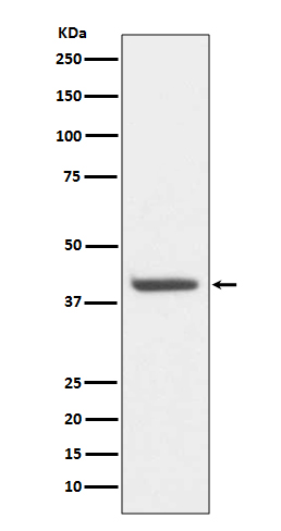 HDAC8 Rabbit mAb ABZ5065