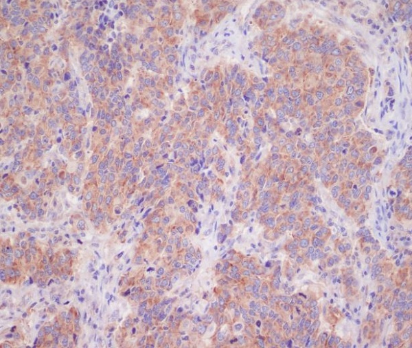 14-3-3 Rabbit mAb ABZ5066