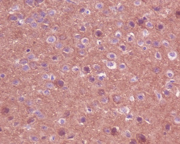 Trk Rabbit mAb ABZ5068
