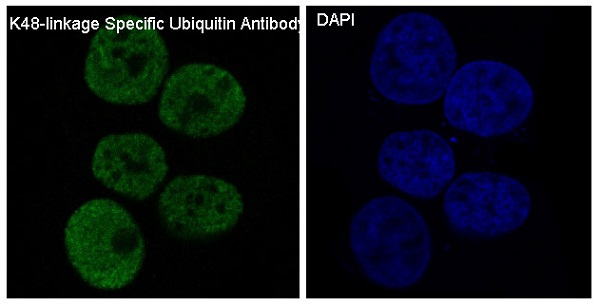 Ubiquitin K48 Rabbit mAb ABZ5070