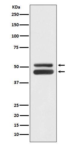 JNK1/3 Rabbit mAb ABZ5072