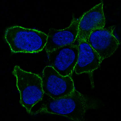 Integrin alpha 5 Rabbit mAb ABZ5074