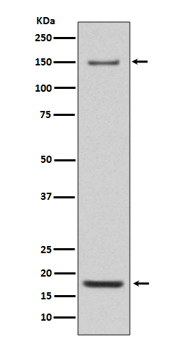 Integrin alpha 5 Rabbit mAb ABZ5074