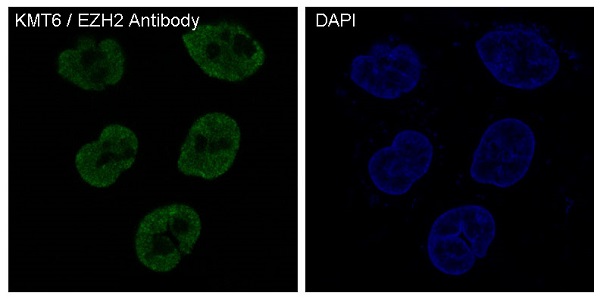 KMT6/EZH2 Rabbit mAb ABZ5075
