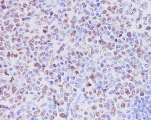 KMT6/EZH2 Rabbit mAb ABZ5075