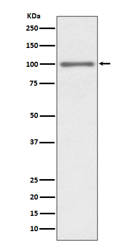 KMT6/EZH2 Rabbit mAb ABZ5075