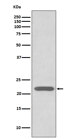 Peroxiredoxin 2 Rabbit mAb ABZ5076