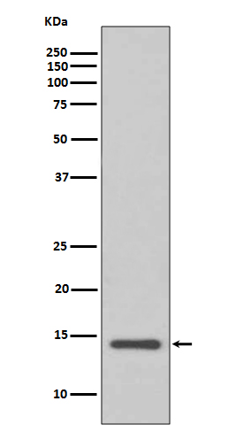 Cystatin C Rabbit mAb ABZ5077