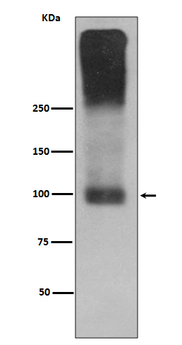 Metabotropic Glutamate Receptor 2 Rabbit mAb ABZ5078