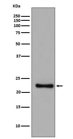 Glutathione Peroxidase 1 Rabbit mAb ABZ5079