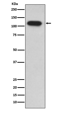 Insulin degrading enzyme Rabbit mAb ABZ5080