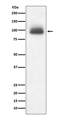 Glucocorticoid Receptor Rabbit mAb ABZ5081