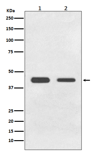 BMP11 Rabbit mAb ABZ5083