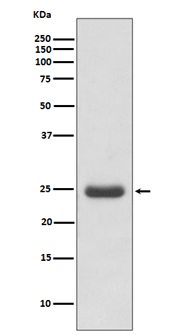 Thymidine Kinase 1/TK1 Rabbit mAb ABZ5084