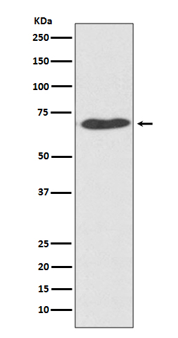 PDIA2/PDIP Rabbit mAb ABZ5085