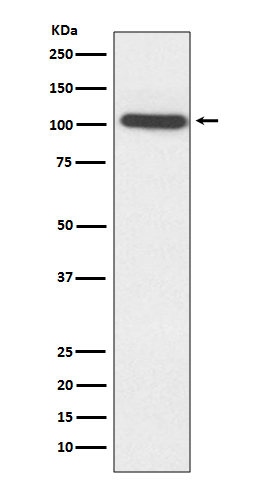 Sarcomeric alpha Actinin Rabbit mAb ABZ5086