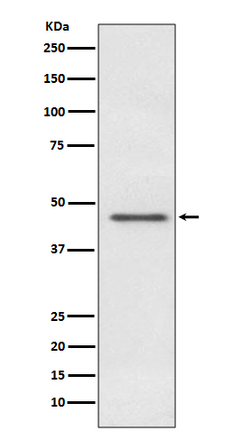 Pyruvate Dehydrogenase E1 alpha Rabbit mAb ABZ5088