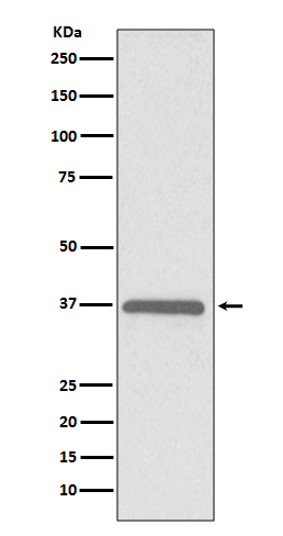 ERCC1 Rabbit mAb ABZ5090
