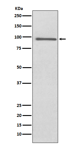 PROX1 Rabbit mAb ABZ5091