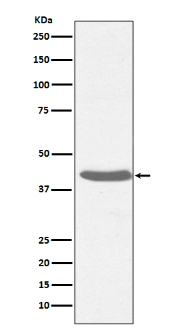 MHC Class I Rabbit mAb ABZ5092