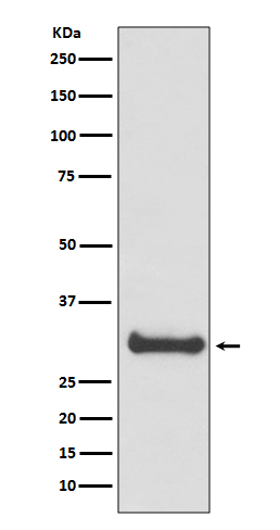 Calbindin Rabbit mAb ABZ5094
