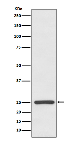 Human kappa Light Chain Rabbit mAb ABZ5096