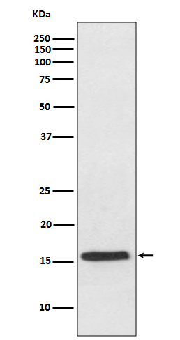 VAMP2 Rabbit mAb ABZ5099