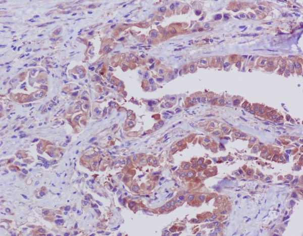 Bid Rabbit mAb ABZ5100