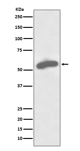 Glucose 6 Phosphate Dehydrogenase Rabbit mAb ABZ5106