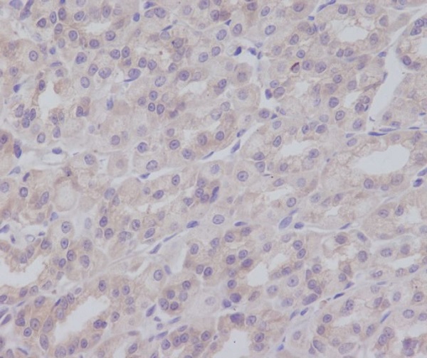 IKK gamma Rabbit mAb ABZ5107