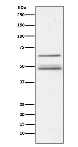 IKK gamma Rabbit mAb ABZ5107
