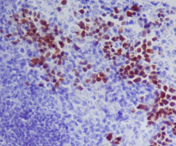 GATA1 Rabbit mAb ABZ5108