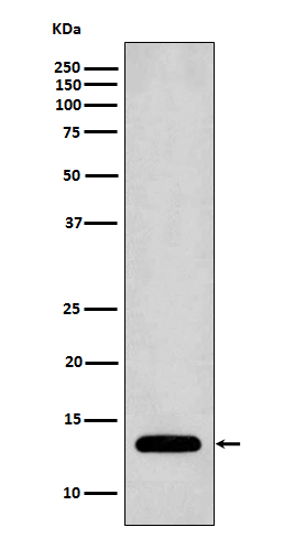 Profilin 1 Rabbit mAb ABZ5109