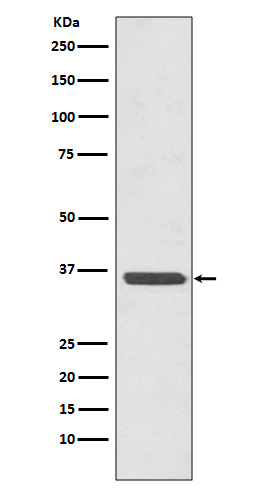 Annexin 2 Rabbit mAb ABZ5110