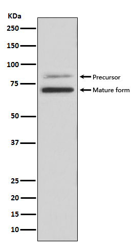 PCSK9 Rabbit mAb ABZ5112