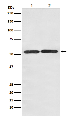 Glucose Transporter GLUT3 Rabbit mAb ABZ5115