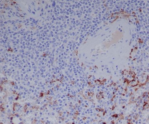 Human IgG Rabbit mAb ABZ5117