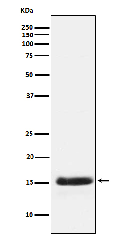 PLGF Rabbit mAb ABZ5119