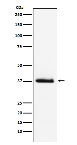 Parathyroid Hormone Rabbit mAb ABZ5120