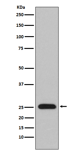 Lambda Light Chain Rabbit mAb ABZ5121