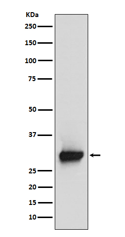 Calretinin Rabbit mAb ABZ5122