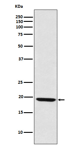 LMO2 Rabbit mAb ABZ5123