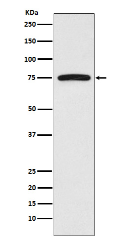 FRS2 Rabbit mAb ABZ5125