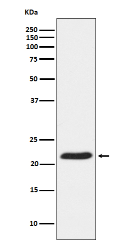 TCTP Rabbit mAb ABZ5132