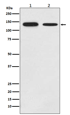 Growth Hormone Receptor Rabbit mAb ABZ5133